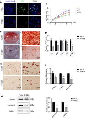 Inflammatory Microenvironment Accelerates Bone Marrow Mesenchymal Stem Cell Aging